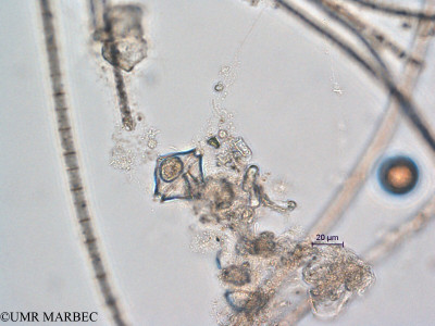 phyto/Scattered_Islands/all/COMMA April 2011/Protoperidinium cf thulesense (ancien P. sp12 cf subinerme recomposé -2)(copy)_thumb.jpg